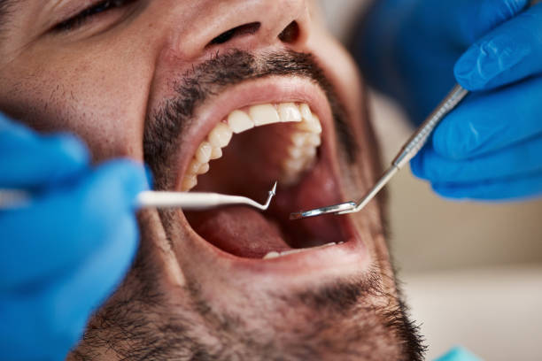Best Weekend Emergency Dental Services in Cherryville, PA