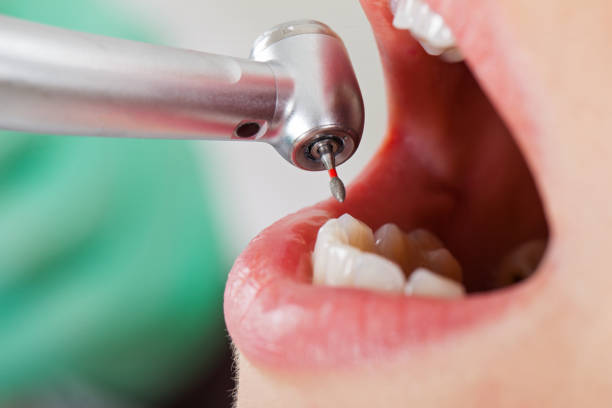 Best Emergency Root Canal Therapy in Cherryville, PA